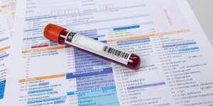 Cholesterol : des symptomes silencieux