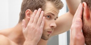 Calvitie : ces 7 boissons augmentent le risque de perte de cheveux