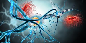 Meningite foudroyante : l-amputation comme sequelle