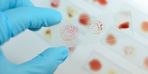 Gastro-enterite : votre groupe sanguin peut determiner votre risque d-infection