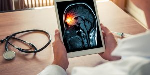 Œdeme cerebral : quel pronostic ?