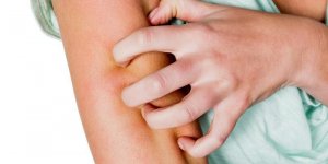 Gonflement et allergie aux piqures de moustique : que faire ?