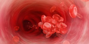 Qu-est-ce qu-une thrombose veineuse superficielle ?