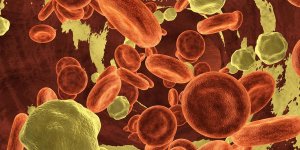 Cholesterol : qu-est-ce que l-hyperlipidemie mixte