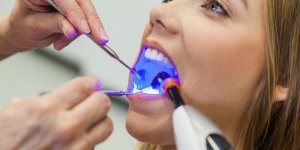 Gencives douloureuses apres detartrage : normal