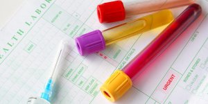 Glucose sanguin ou glucose urinaire : la difference