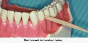 L’hygiene bucco-dentaire de l’adulte