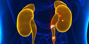 Maladies des reins : 5 causes qui augmentent le risque chez les femmes