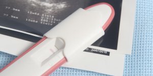 A quoi sert la premiere echographie de grossesse