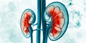 Cancer du rein : le traitement par ablation chirurgicale