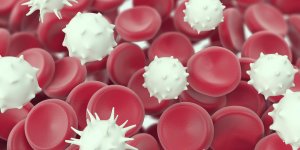 Cancer du sang ou lymphome : la difference
