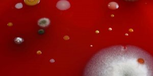Fievre charbonneuse : une importante epidemie sevit dans les Hautes-Alpes