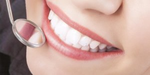 Kit de blanchiment des dents : comment ca fonctionne ?