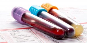 6 raisons cachees qui peuvent faire exploser vos Gamma GT
