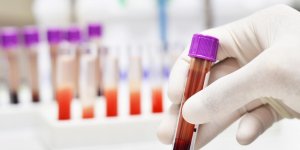 Maladie de Charcot : une simple prise de sang pour la diagnostiquer ?