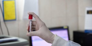 Taux de creatinine : a quoi ca sert ?