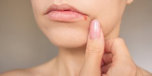 Alzheimer : Le virus de l-herpes serait-il implique dans sa survenue ?