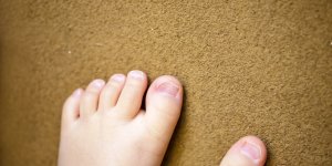 Ebouillantee par sa grand-mere, une fillette de 2 ans pourrait perdre ses pieds