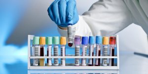 Lymphome : le diagnostic par prise de sang