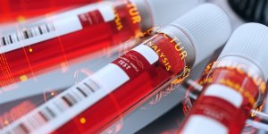 Coronavirus : qu-est-ce qu-un test serologique ?