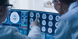 Tumeur au cerveau : quelles sont les statistiques de survie ?