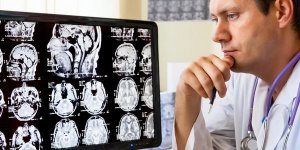 Une nouvelle technique pour empecher Alzheimer de se developper