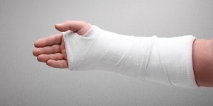 Fracture spontanee : un symptome de cancer des os ?