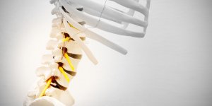 Arthrose lombaire : les infiltrations articulaires de corticoides