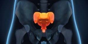 Douleur au coccyx sans chute : un signe de sciatique ?