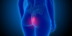 Cancer de l-anus : quels sont les symptomes ?