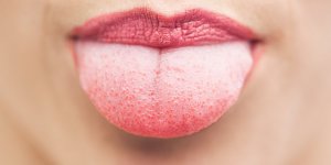 Apnee du sommeil : les langues "grasses" seraient responsables des ronflements