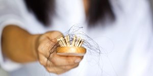 Obesite : manger gras rend vos cheveux plus fins et accelere leur chute