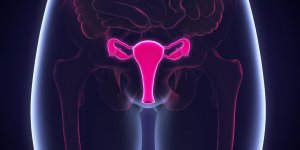 Cancer de l-ovaire : une evolution possible vers le peritoine