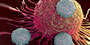 Cancer du sein : la tumeur qui se voit mal chez les femmes qui ont des kilos en trop