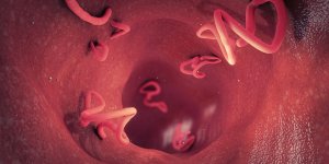 Ces symptomes qui montrent que vous avez des parasites intestinaux
