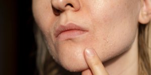 Ce que votre visage dit de vous (hormone et carence)