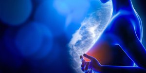 Cancer du sein : les 20 departements les plus touches 
