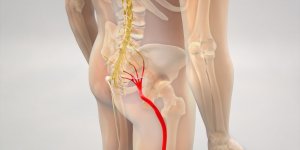 Sciatique : 5 huiles essentielles qui soulagent les douleurs