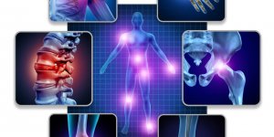  Arthrose : 6 complements alimentaires a eviter selon 60 millions de consommateurs