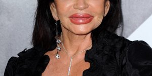 Les rates de la chirurgie esthetique