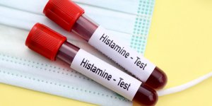 9 facteurs qui peuvent contribuer au desequilibre de l’histamine, cette molecule essentielle a notre sante