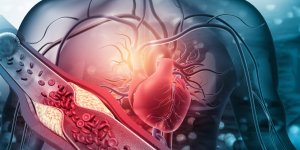 Les 7 conseils de la cardiologue pour eviter d’avoir les arteres bouchees