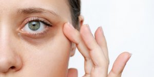 Cernes : 5 astuces alimentaires pour les contrer