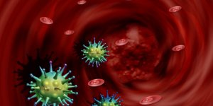 Choc septique : 5 signes qui doivent alerter