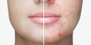 Visage : ce que vous devez arreter de faire pour avoir une belle peau 