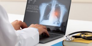 Connaissez-vous bien les symptomes de l’œdeme pulmonaire ?