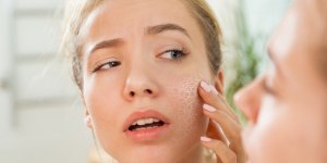 Hiver : 5 signes qui montrent que votre peau souffre du froid