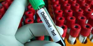 Saviez-vous que ces 7 maladies augmentent le taux de cholesterol ?
