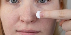 Peau qui pele : 6 astuces pour s-en debarrasser