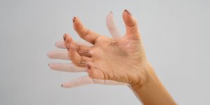 Parkinson : 5 facteurs de risque ont ete decouverts par une etude